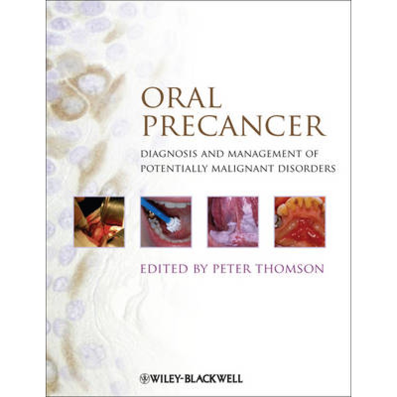 Oral Precancer: Diagnosis and Management of Potentially Malignant Disorders